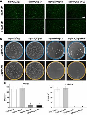 A surface metal ion-modified 3D-printed Ti-6Al-4V implant with direct and immunoregulatory antibacterial and osteogenic activity